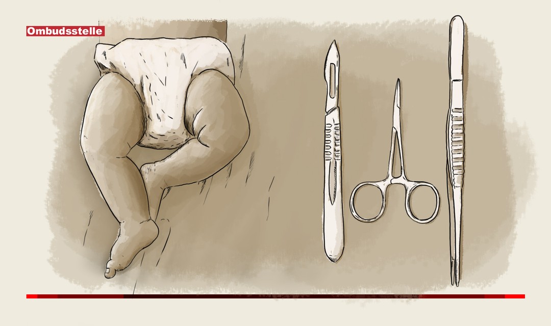 Illustration: links ein Kleinkind in Windeln, rechts chirurgische Instrumente (Skalpell, Klemme, Pinzette)